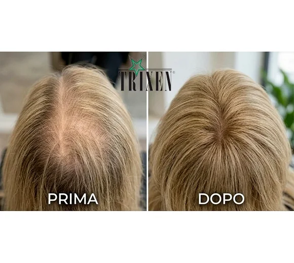 Topper con Base Invisibile e Traspirante, prodotto della selezione Trixen