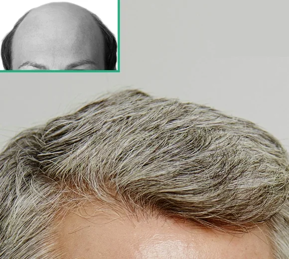 Toupet uomo capelli veri riducibile con lace front, prodotto della selezione Trixen